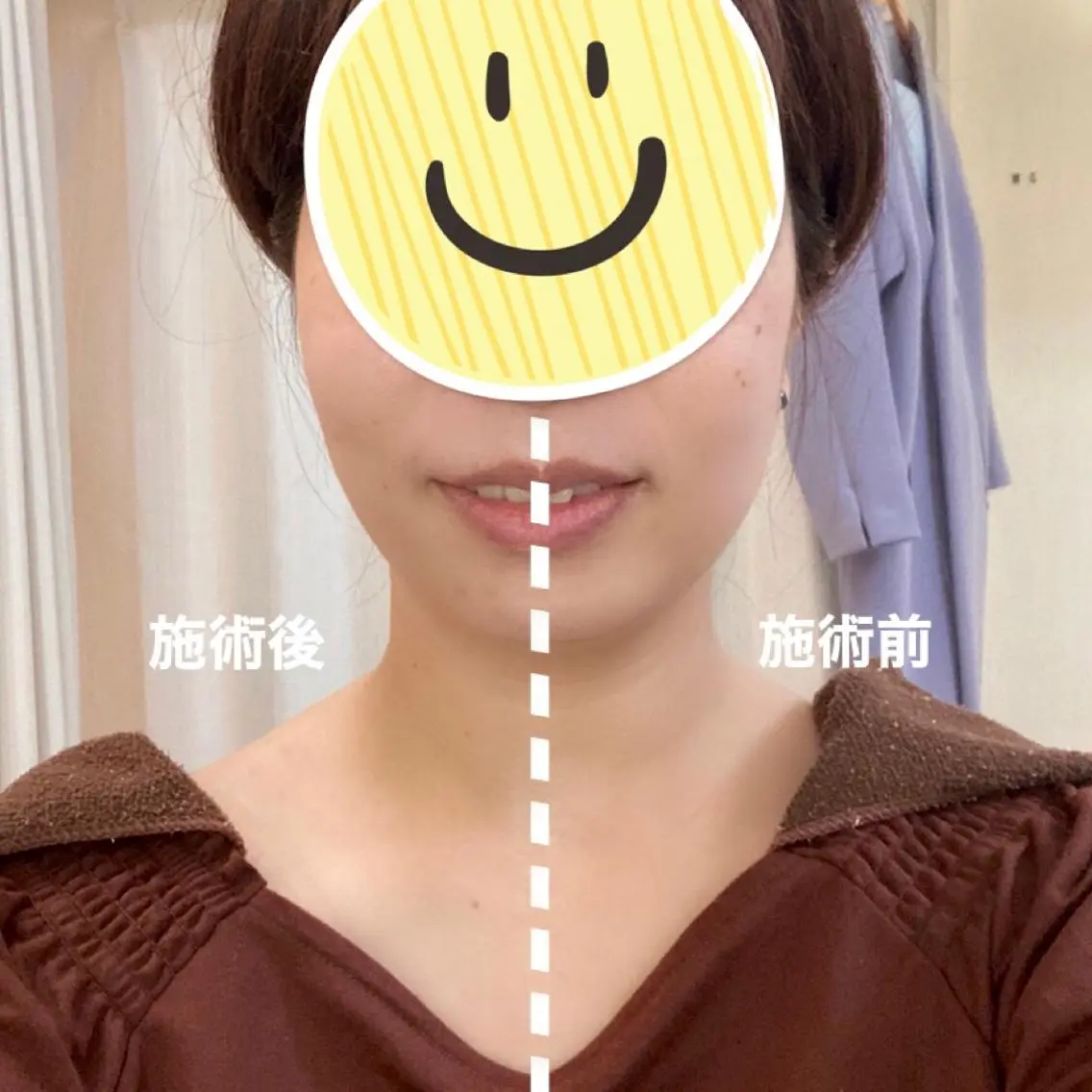 エステ リラク 小顔美肌&ヘアメイク 丸山紗來のその他イメージ