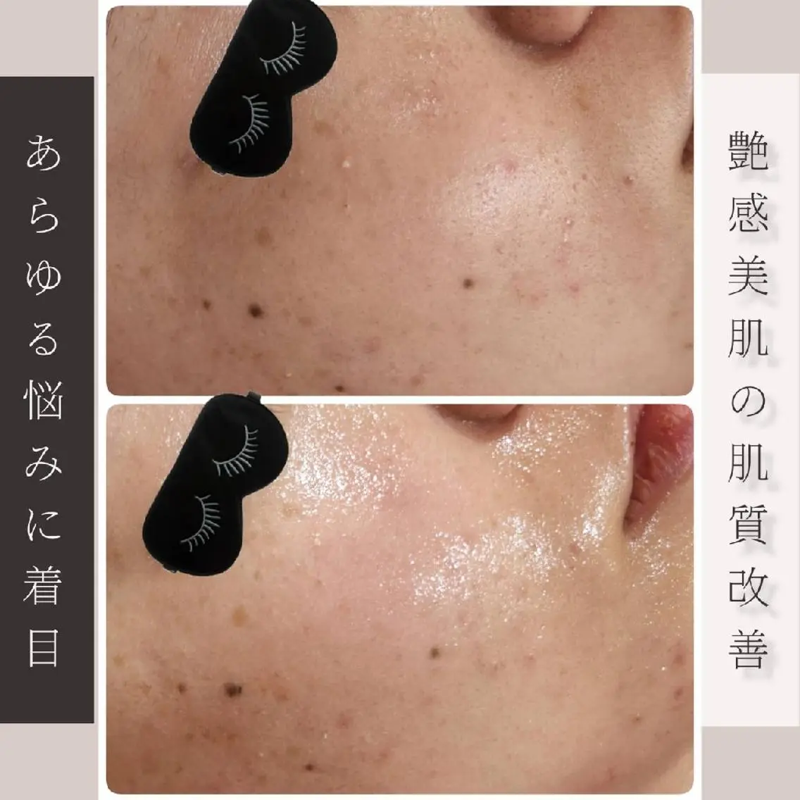 エステ リラク Glossy salonのエステ・リラクイメージ