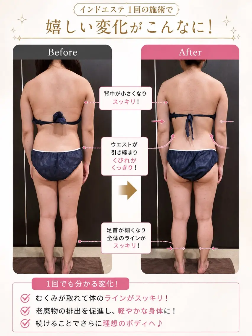 インド痩身エステの写真