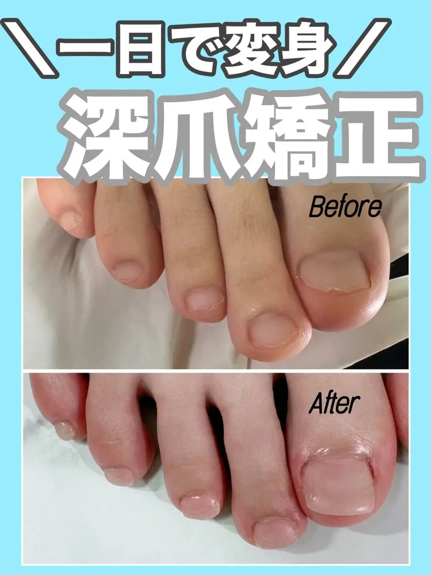 ネイル クリアネイル フットネイル フットネイル nail salon petillantのネイルデザイン