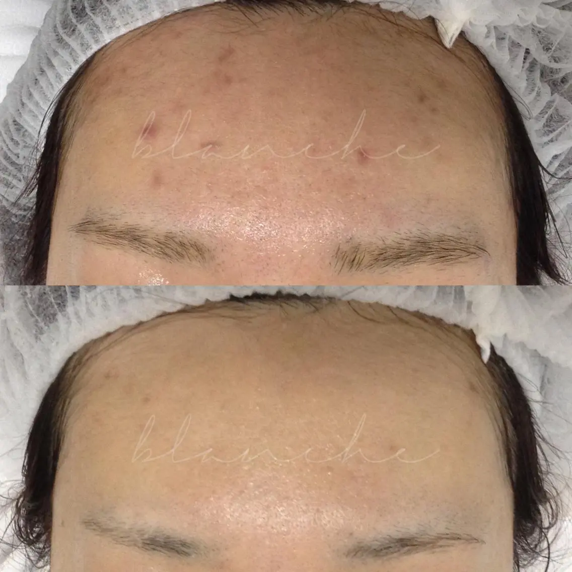ロング カラー パーマ ヘアアレンジ ネイル マツエク・マツパ アイブロウ エステ リラク 都度払い肌質改善 &脱毛Blancheのエステ・リラクイメージ