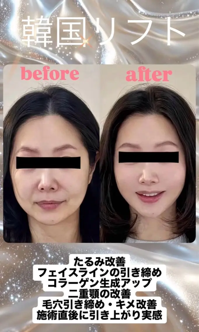 マツエク・マツパ エステ リラク 愛維美水光美肌専門店 メンズレディースokのエステ・リラクイメージ