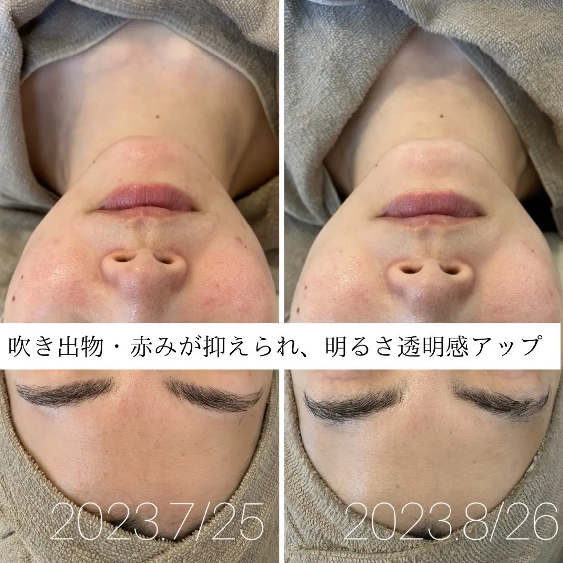 エステ Lassy Yuriの眉毛・アイブロウイメージ