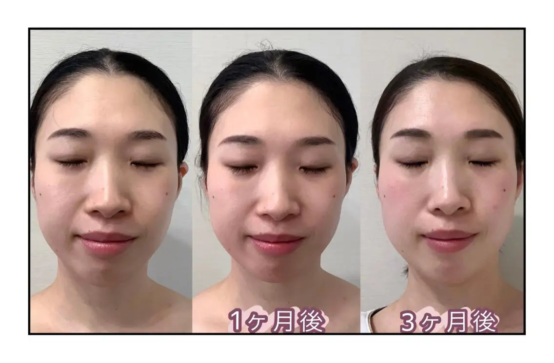 ヘアアレンジ ネイル マツエク・マツパ エステ QANAEL 小山のエステ・リラクイメージ
