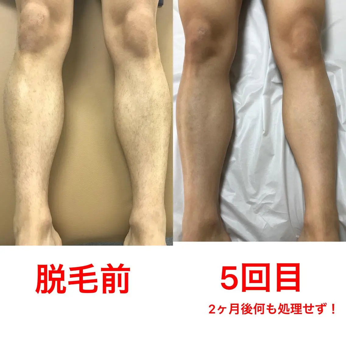 メンズ 脱毛 メンズ脱毛サロン /金山昌弘のエステ・リラクイメージ