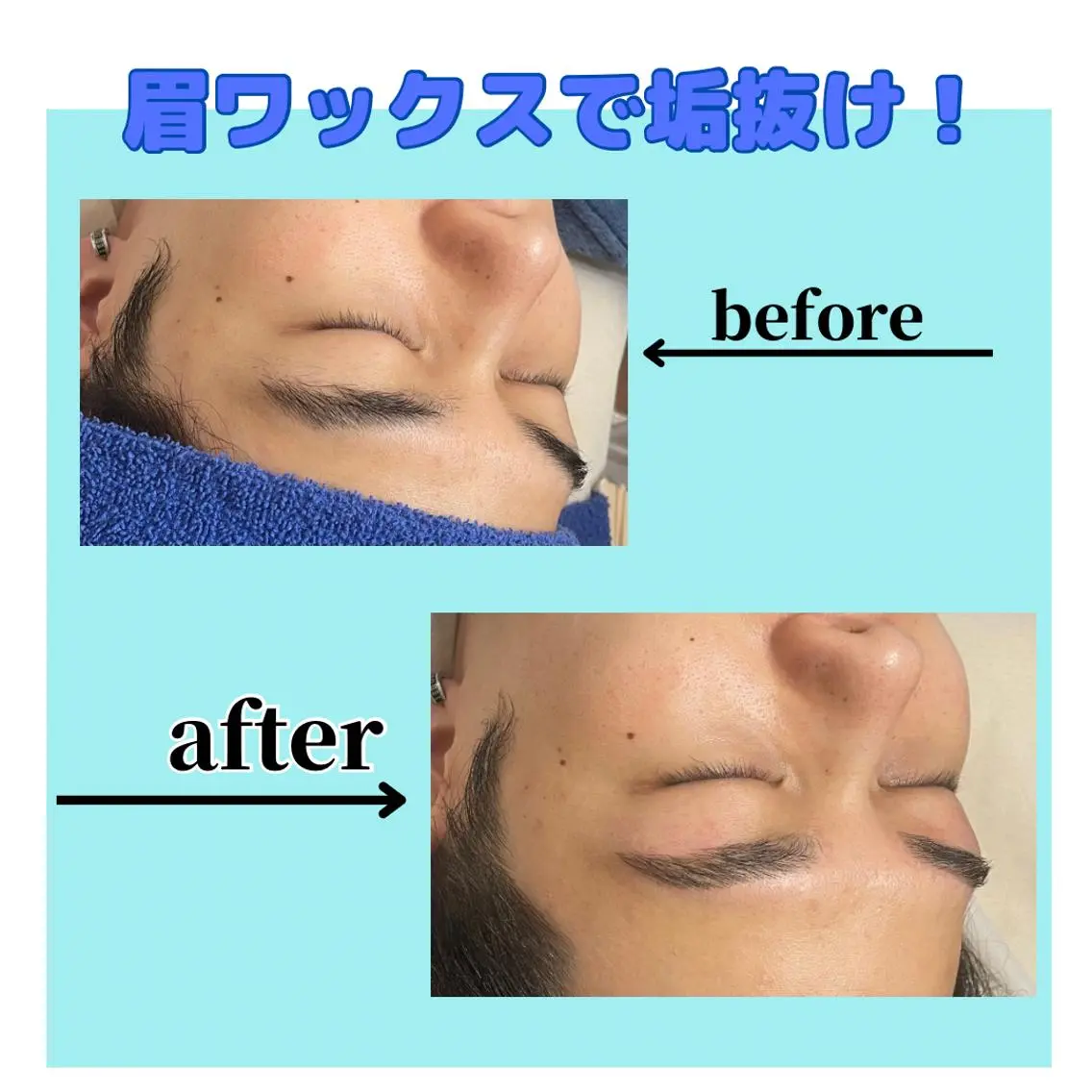 ●ミニモ限定【メンズ眉ワックス脱毛】◎¥2500の写真