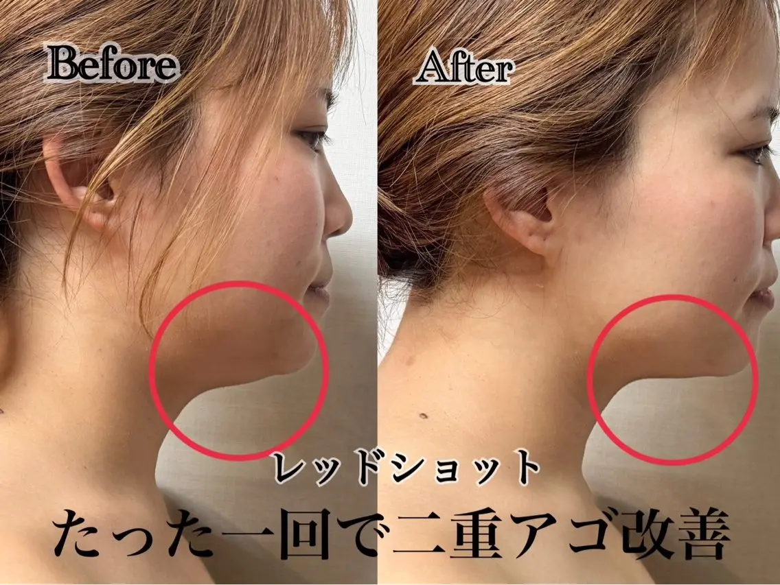 六本木脱毛andS Saoriのエステ・リラクイメージ