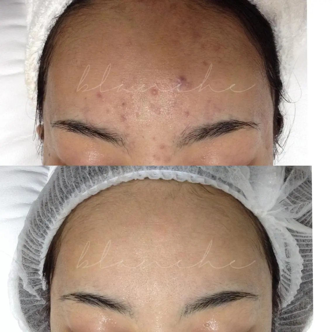 ロング カラー パーマ ヘアアレンジ ネイル マツエク・マツパ アイブロウ エステ リラク 都度払い肌質改善 &脱毛Blancheのエステ・リラクイメージ