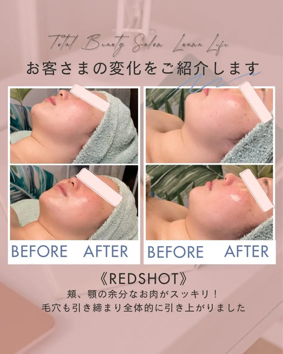 その他 肌改善・脱毛・痩身 LuanaLifeのエステ・リラクイメージ