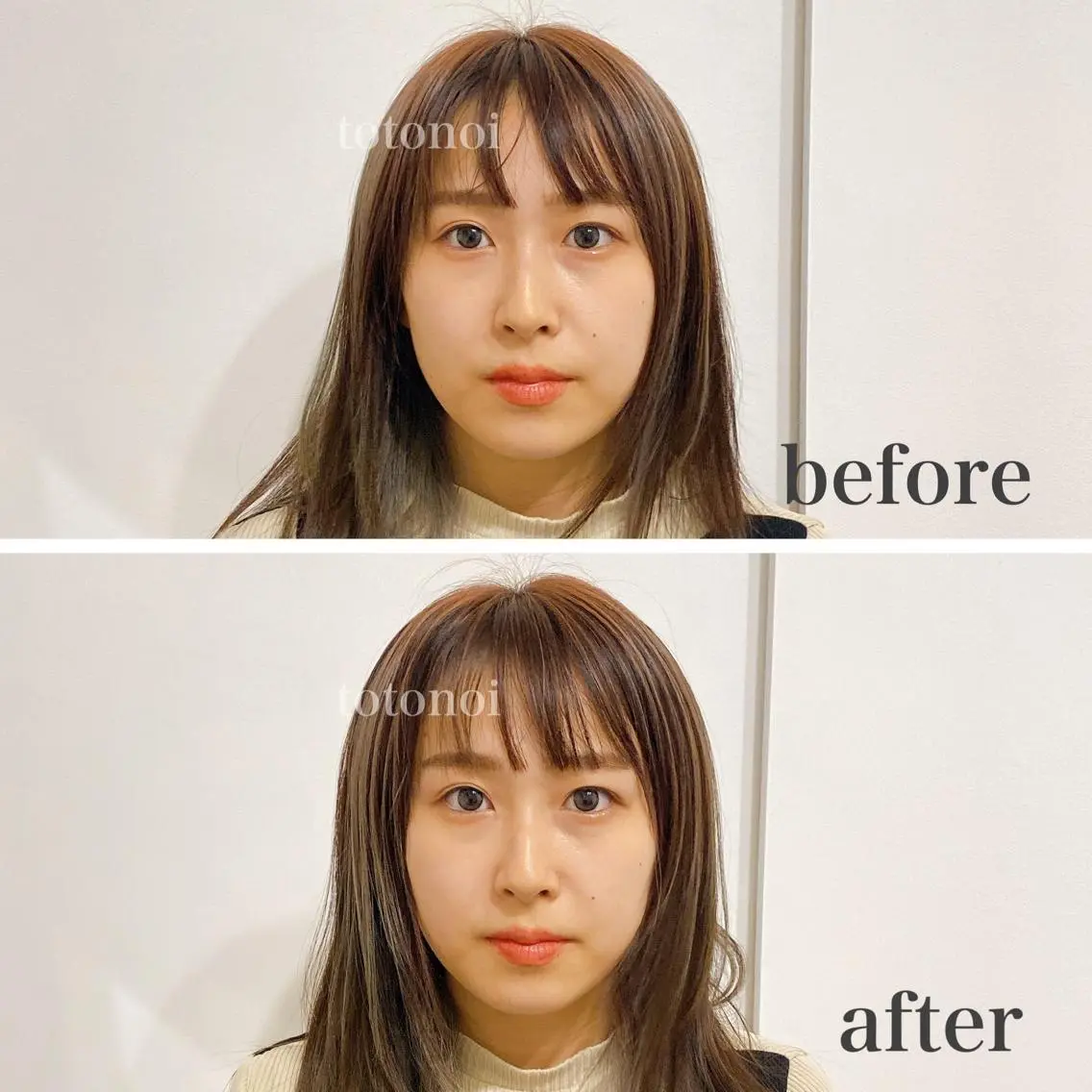 印象の良くなる 美容鍼のエステ・リラクイメージ