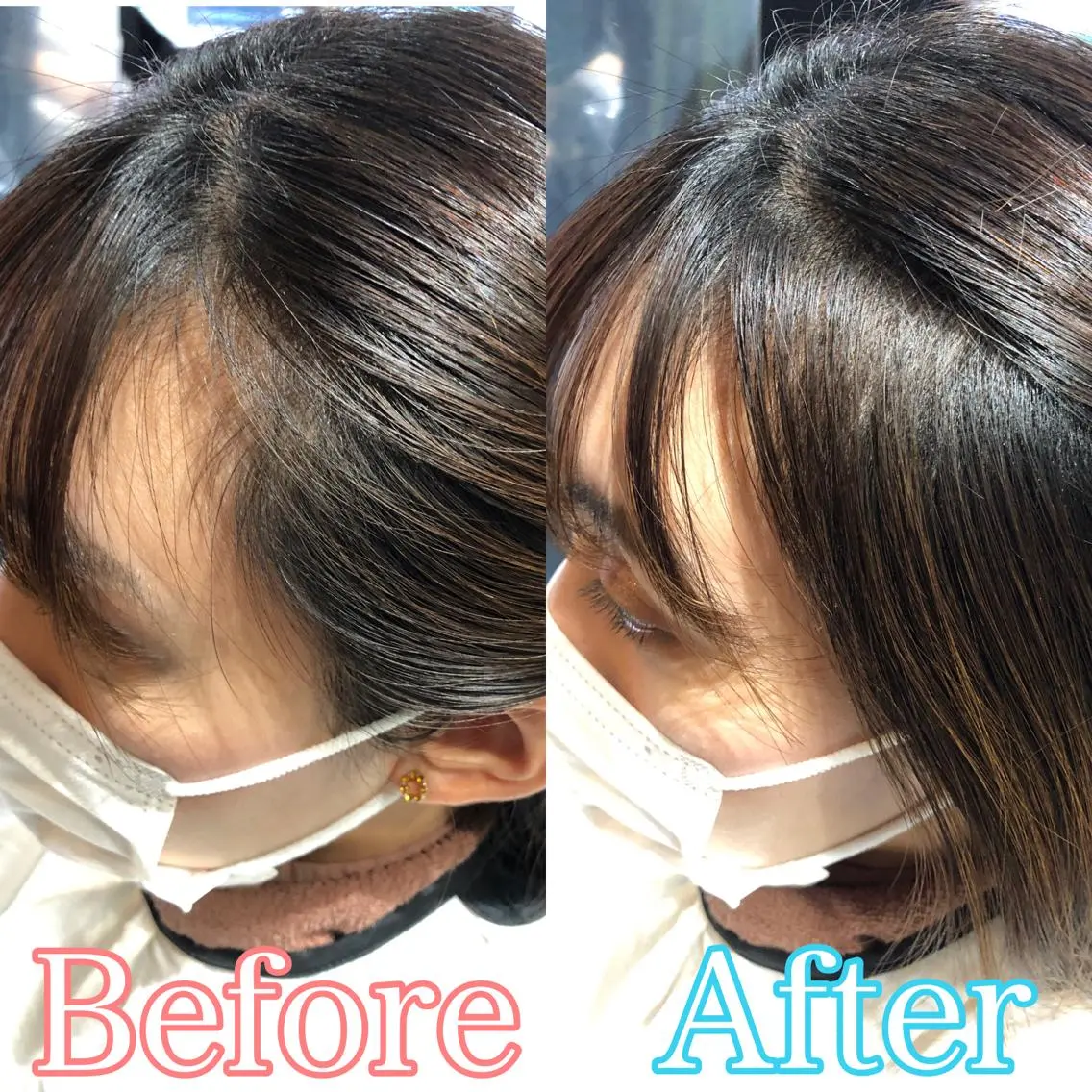 おでこやこめかみのすきまが気になる方に✨前髪カット＋うぶ毛カットの写真