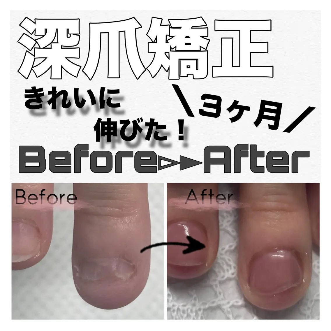 ネイル アートネイル クリアネイル ジェルネイル ピンク nail salon petillantのネイルデザイン
