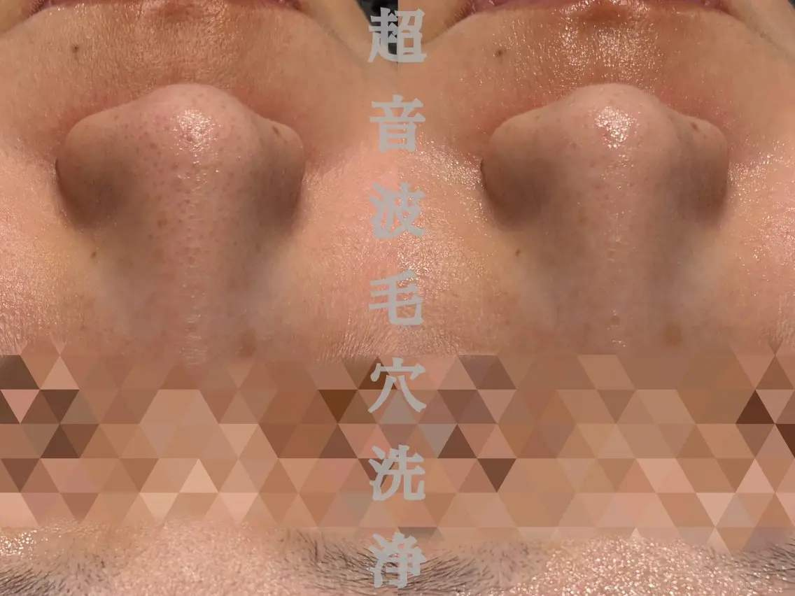 その他 Esthetic ReTweetのエステ・リラクイメージ