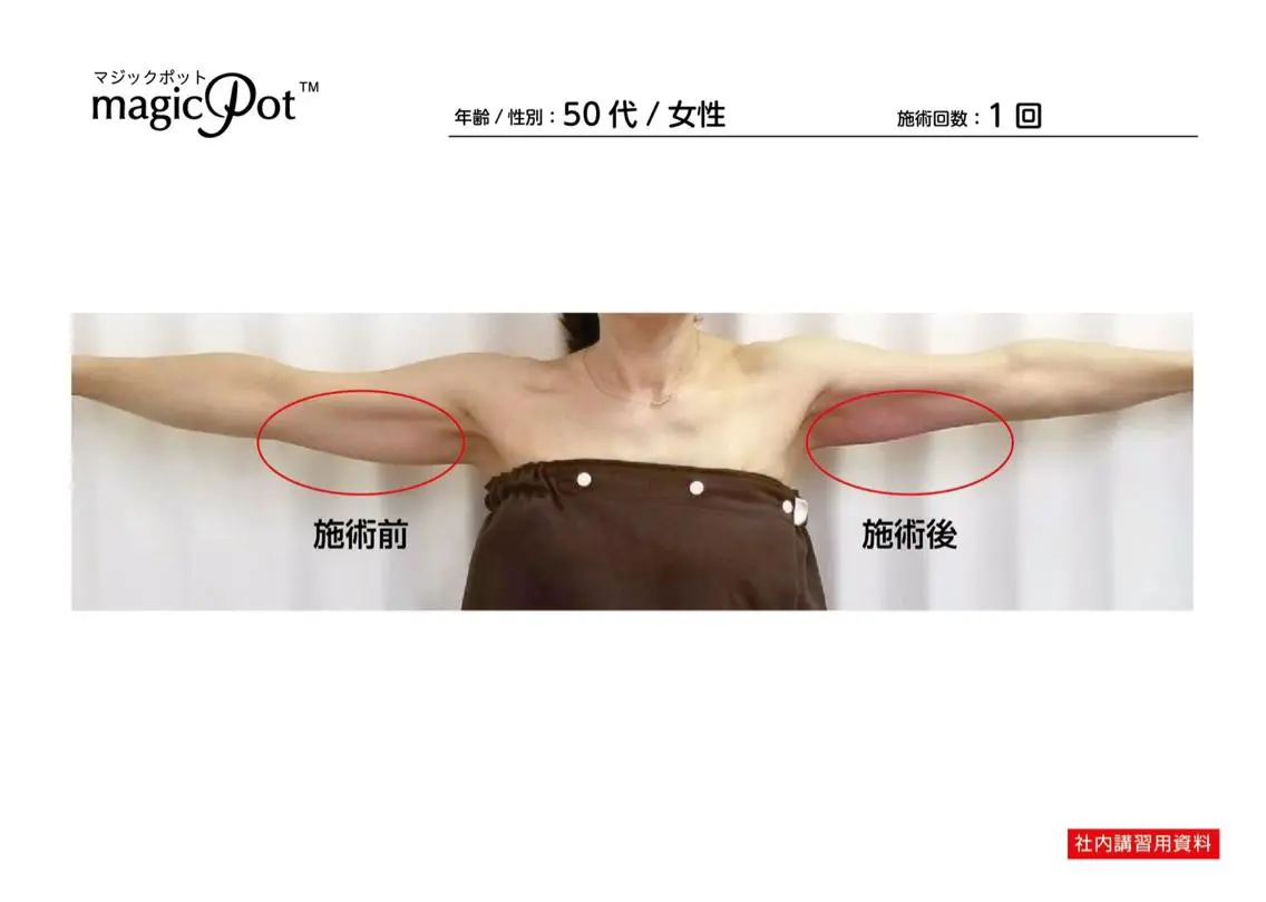 心斎橋痩身ダイエット 韓国.美容鍼.小顔のエステ・リラクイメージ