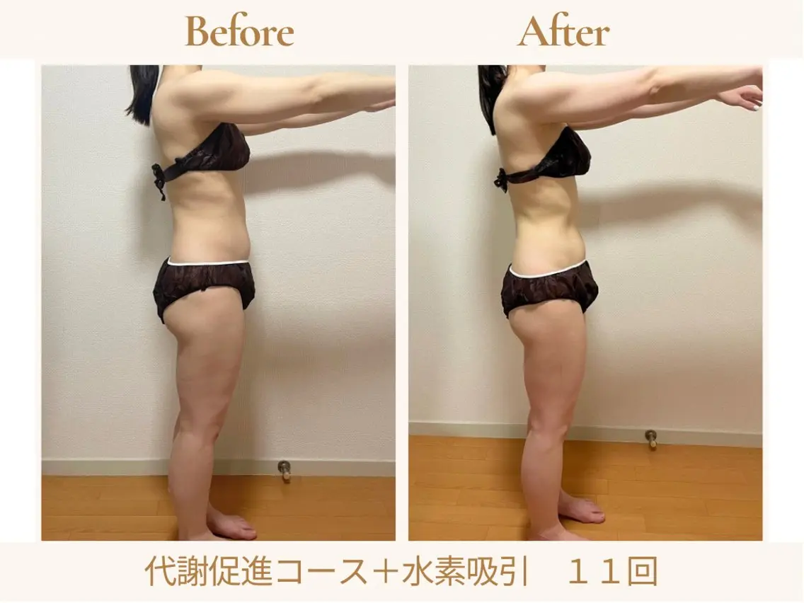 あみ|痩身の最先端 よもぎ蒸しサロン大塚のエステ・リラクイメージ