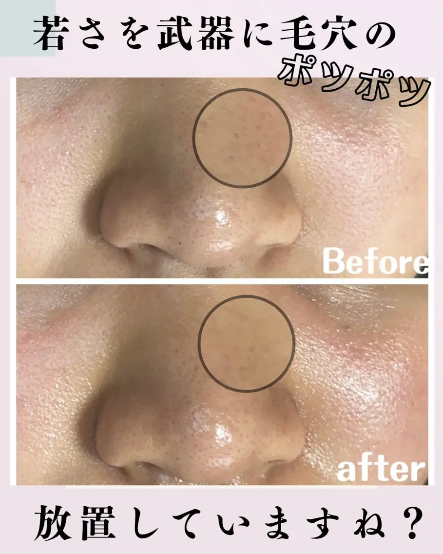 エステ リラク 肌質改善サロン facialmoonのエステ・リラクイメージ