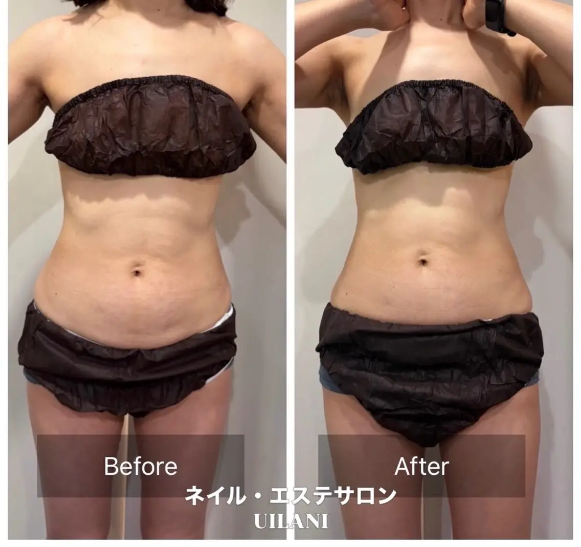 ネイル・エステサロン UILANIのエステ・リラクイメージ