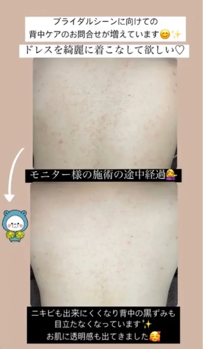 エステ ベラージュ【美背中・ 美尻・フェイシャル】のエステ・リラクイメージ