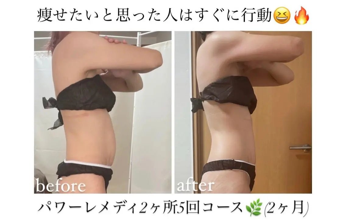 《本気痩せ×疲労改善 》 BILOOPのエステ・リラクイメージ