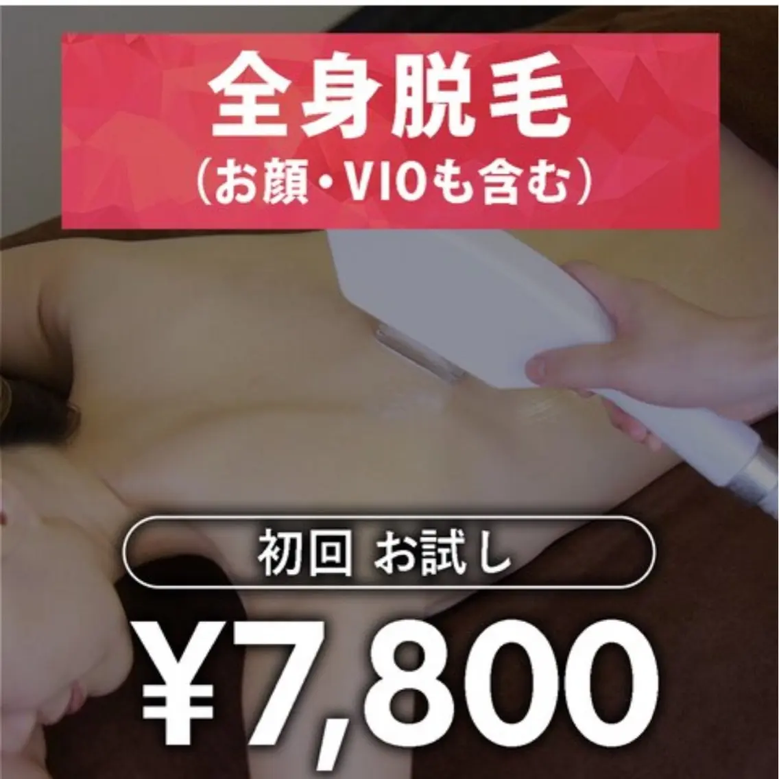 女性全身脱毛お試し7800円税込VIOお顔含むの写真