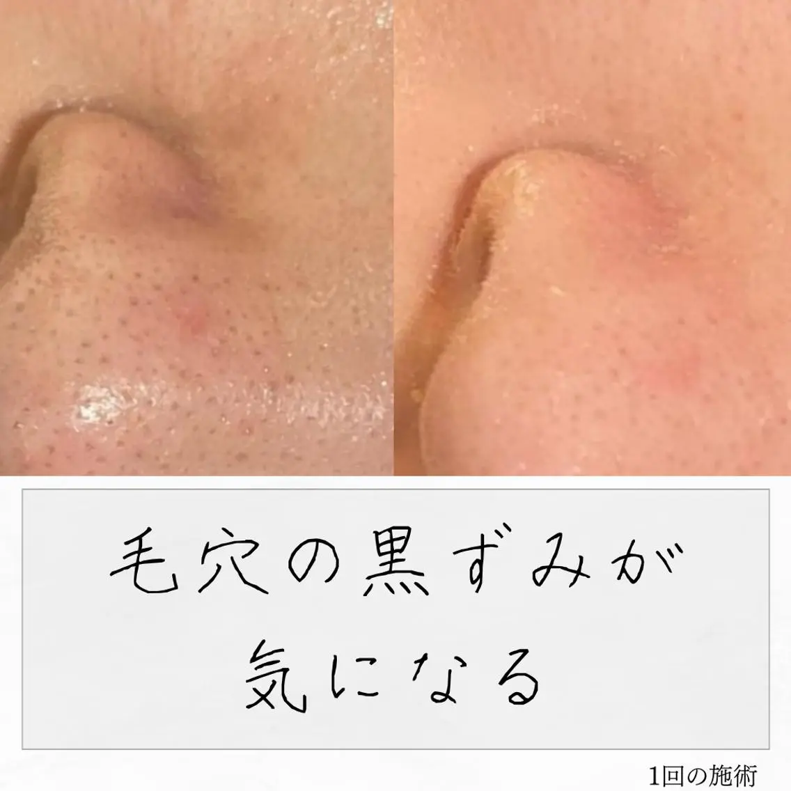 ニキビ経験者が施術 する専門サロン🌻のエステ・リラクイメージ