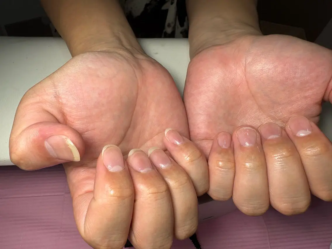 メンズハンドケア✨爪の強度アップ⤴️の写真