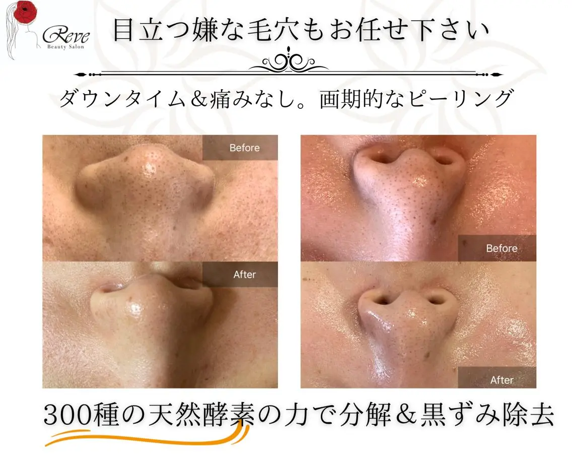 エステ リラク 堀井 舞琳のエステ・リラクイメージ