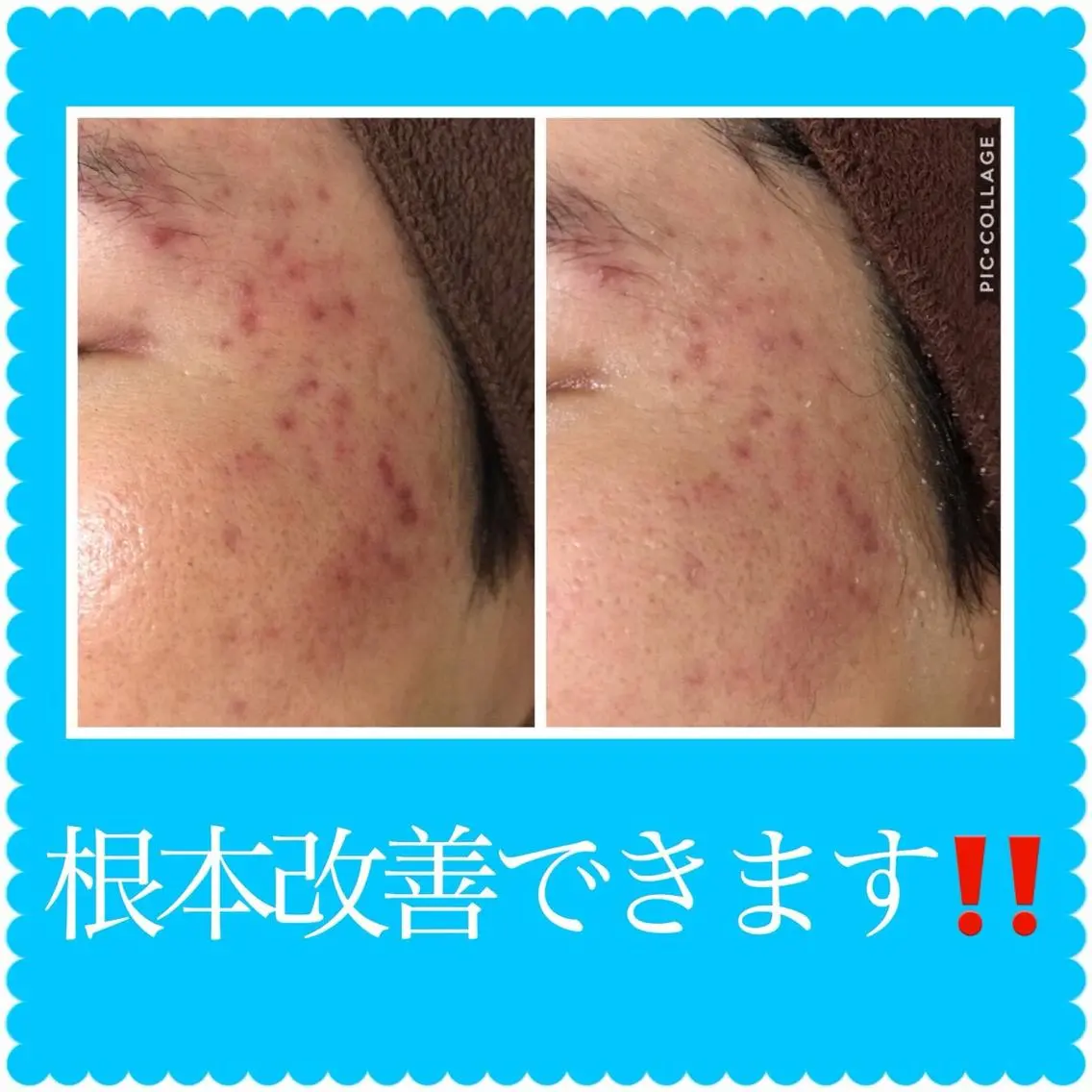 ミディアム カラー パーマ ヘアアレンジ メンズ キッズ ネイル マツエク・マツパ ニキビ・肌質改善専門 ♡人生が変わるサロンのエステ・リラクイメージ