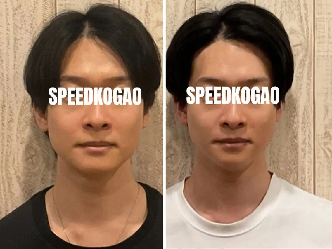 エステ リラク 小顔矯正Speed KOGAO渋谷本店のエステ・リラクイメージ