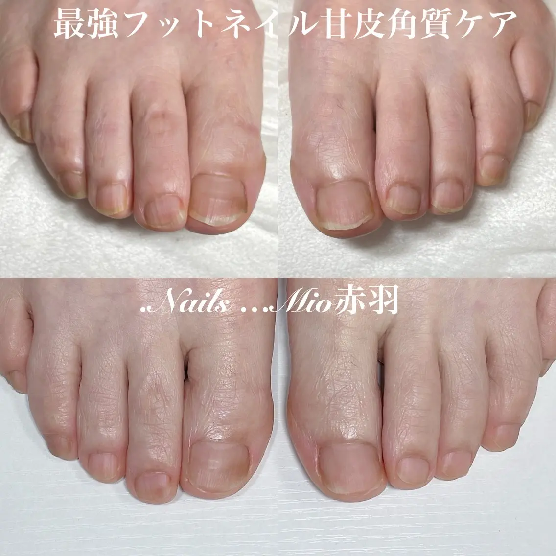 ネイル フットネイル 赤色 .Nails Mio 赤羽西ネイルサロンのネイルデザイン