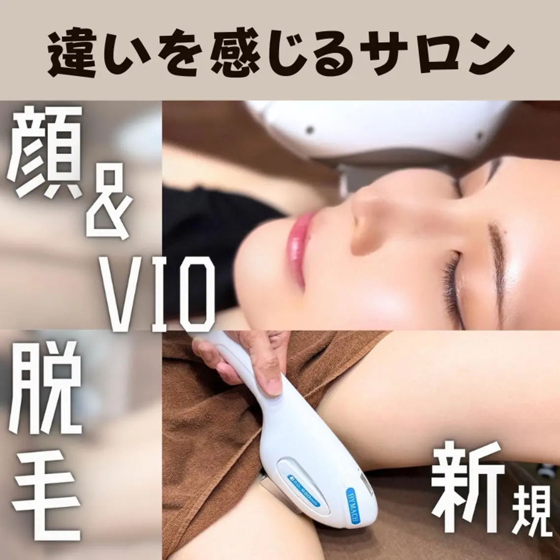 （初回）【レディース】顔全体+VIO 人気の2箇所をまとめてお得に！の写真
