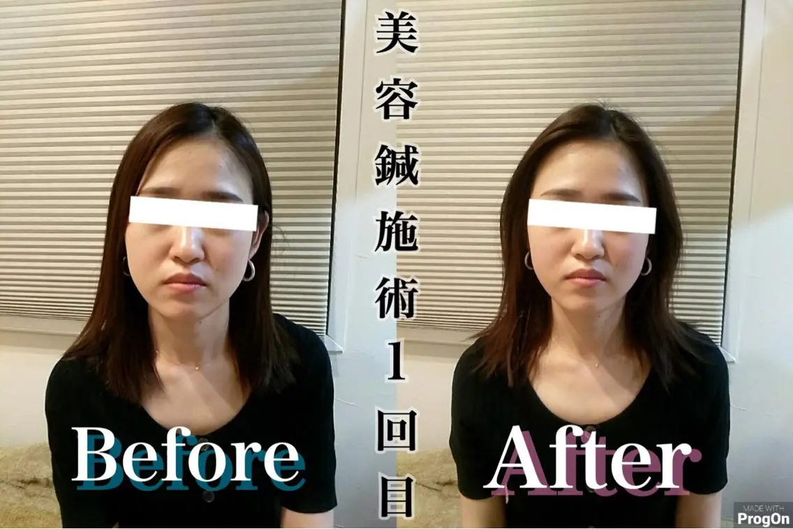 鍼灸 Refineのその他イメージ