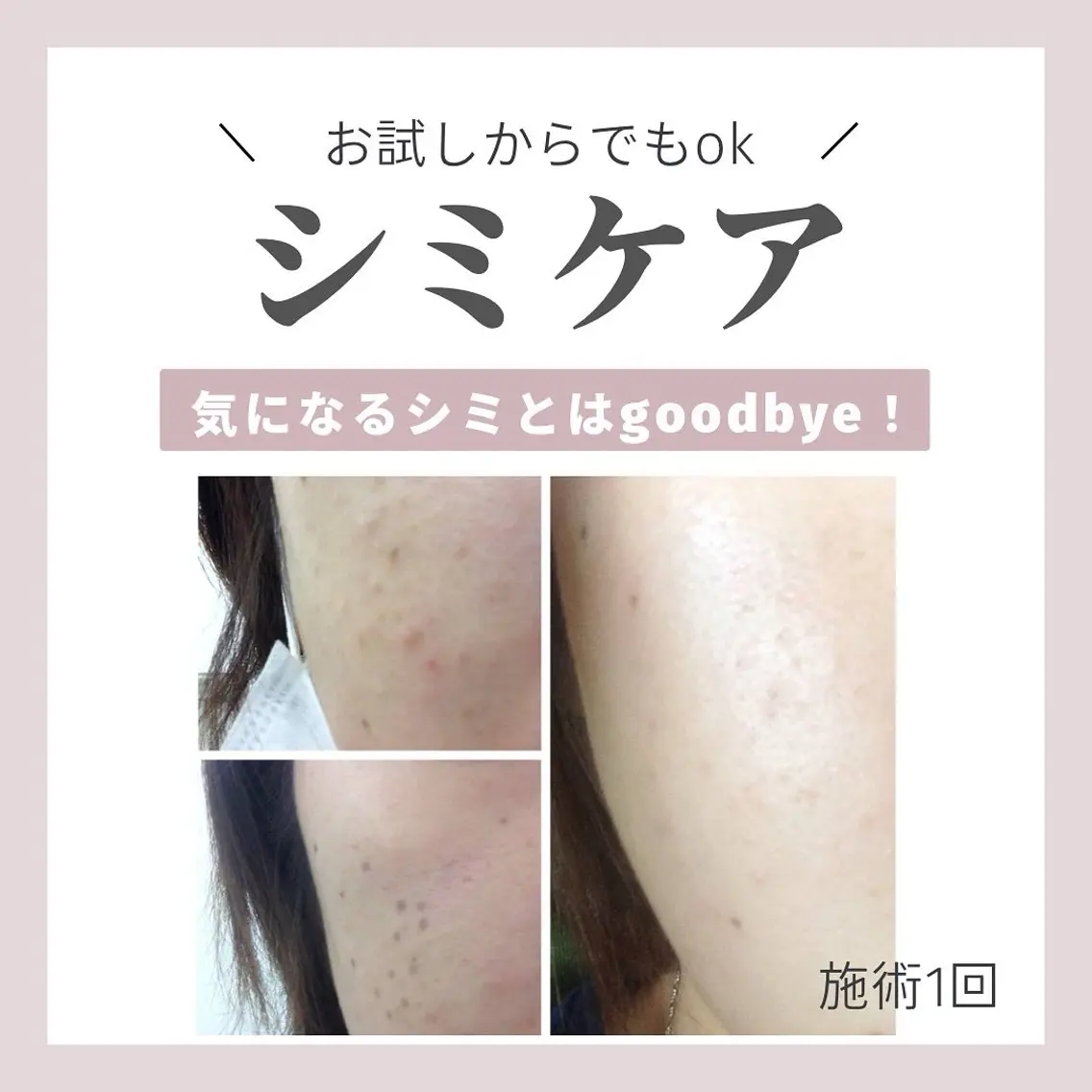 曽根 理奈のエステ・リラクイメージ