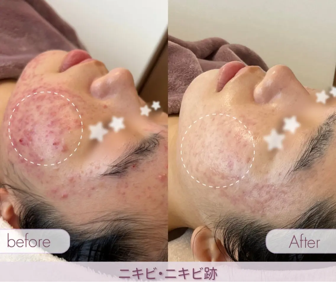 その他 肌質改善サロン ココマヒナのエステ・リラクイメージ