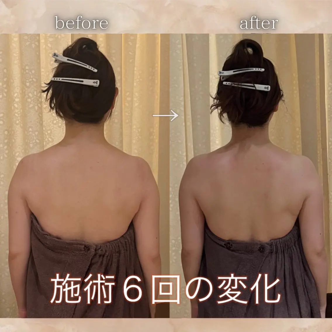 【挙式直前限定💐】背中・二の腕・鎖骨ライン仕上げコース 90分の写真