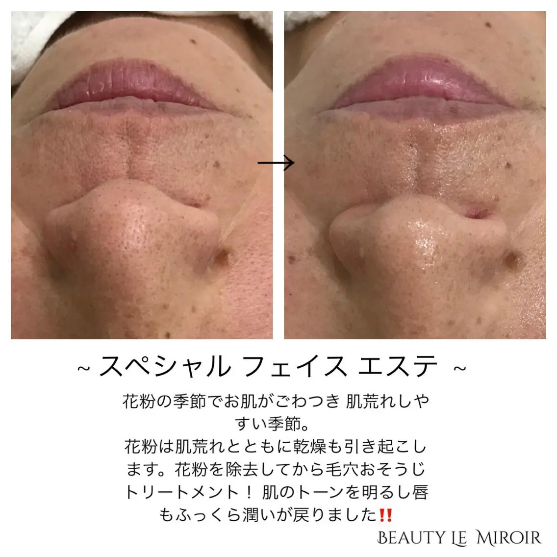 ビューティー ミロワールのエステ・リラクイメージ