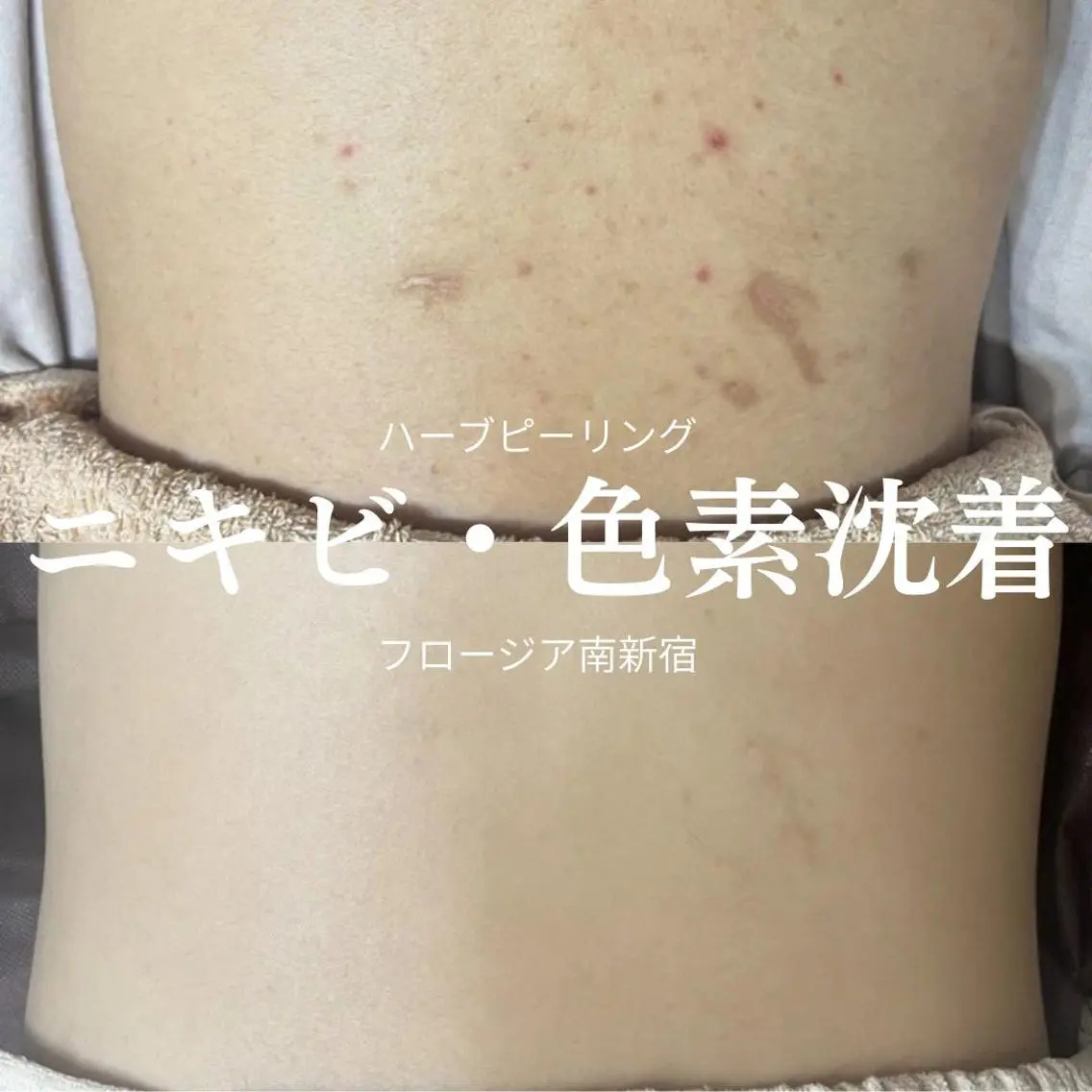 MI SUZUのエステ・リラクイメージ