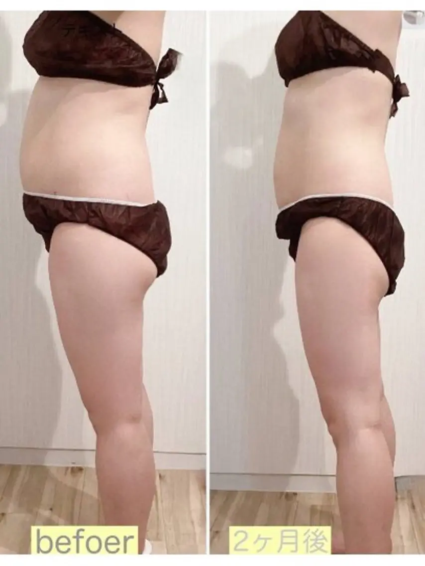 骨盤矯正ダイエット 結果出し＊痩身マシンのエステ・リラクイメージ