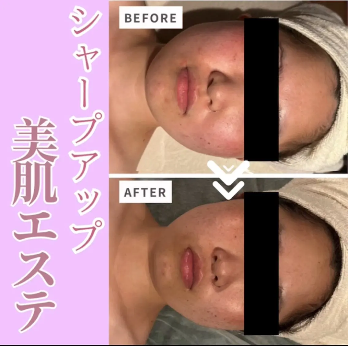 肌別対応フェイシャルエステ初回60分の写真