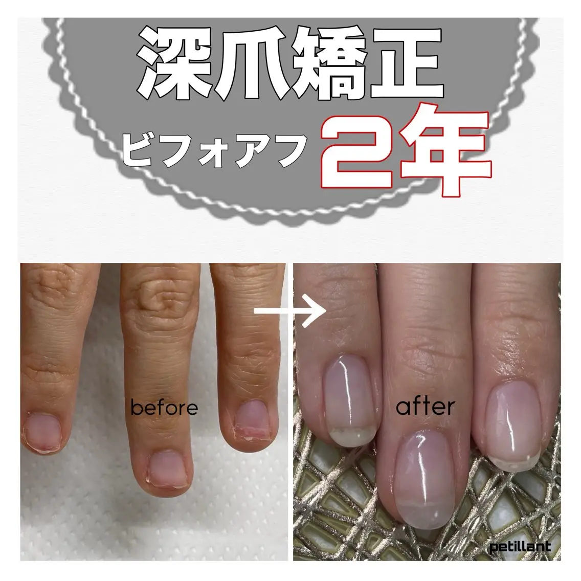 ネイル クリアネイル ジェルネイル ピンク nail salon petillantのネイルデザイン