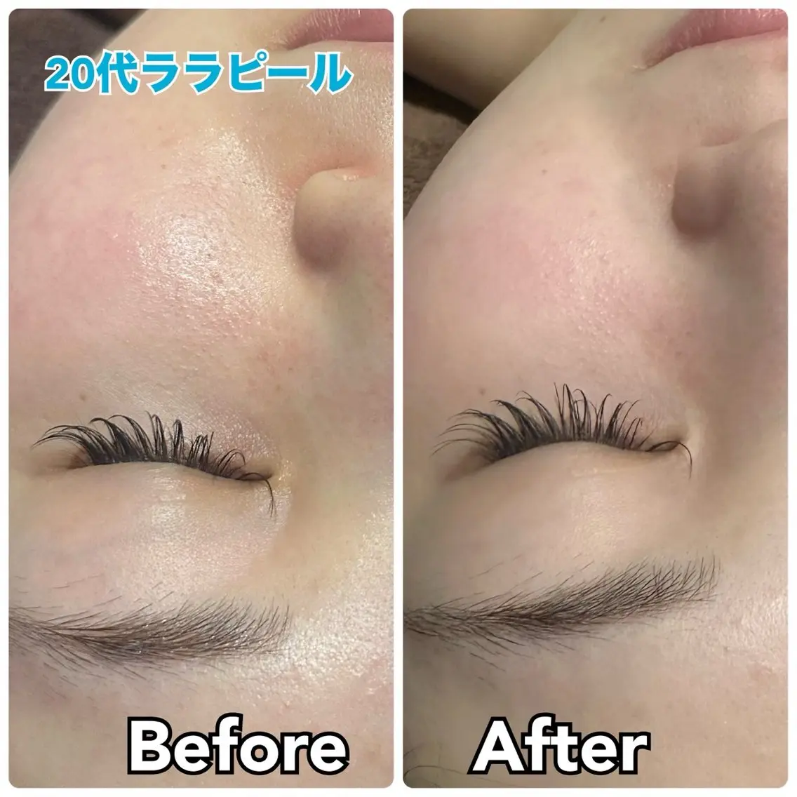 エステ 【毛穴・美白・美肌】 美・up 青葉台店のエステ・リラクイメージ