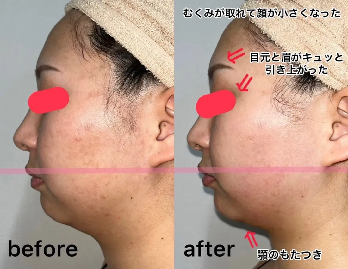 メンズ エステ salonde ReGodのエステ・リラクイメージ