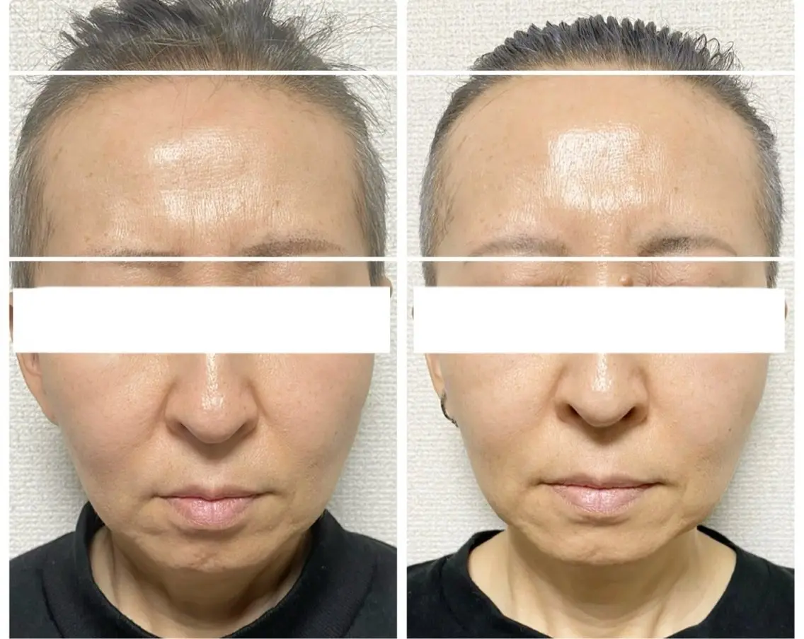 【特別価格】美肌エイジングケアフェイシャル【当店フェイシャル人気No1を最大3回まで利用可能】※数量限定の写真