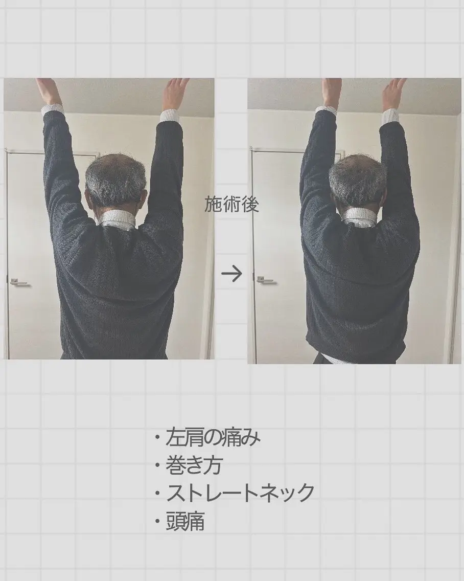 整体サロンViola 肩こり/猫背/疲労のエステ・リラクイメージ