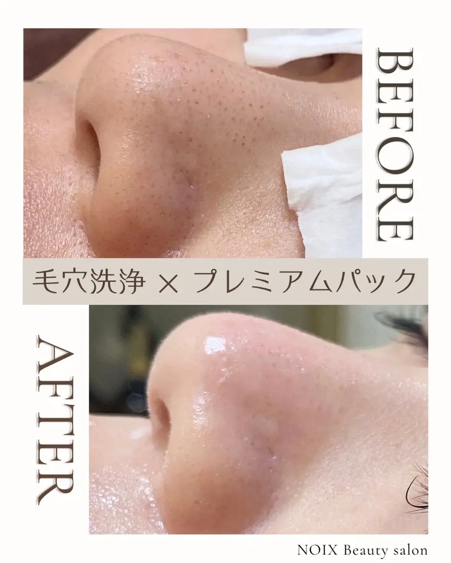 NOIXbeauty salonのエステ・リラクイメージ