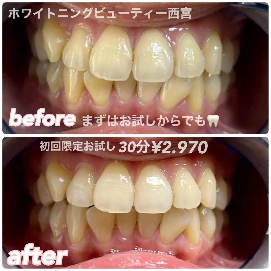ホワイトニングビュー ティー西宮店のその他イメージ