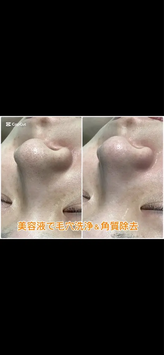 エステ M 🌱naturalのエステ・リラクイメージ