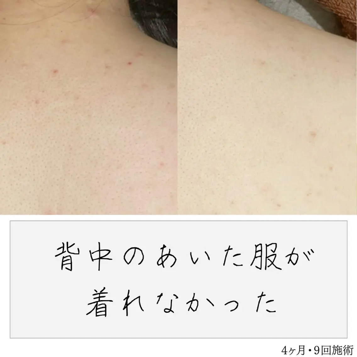 ニキビ経験者が施術 する専門サロン🌻のエステ・リラクイメージ