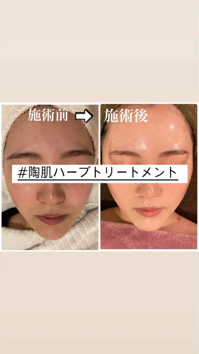 上地 怜那のエステ・リラクイメージ