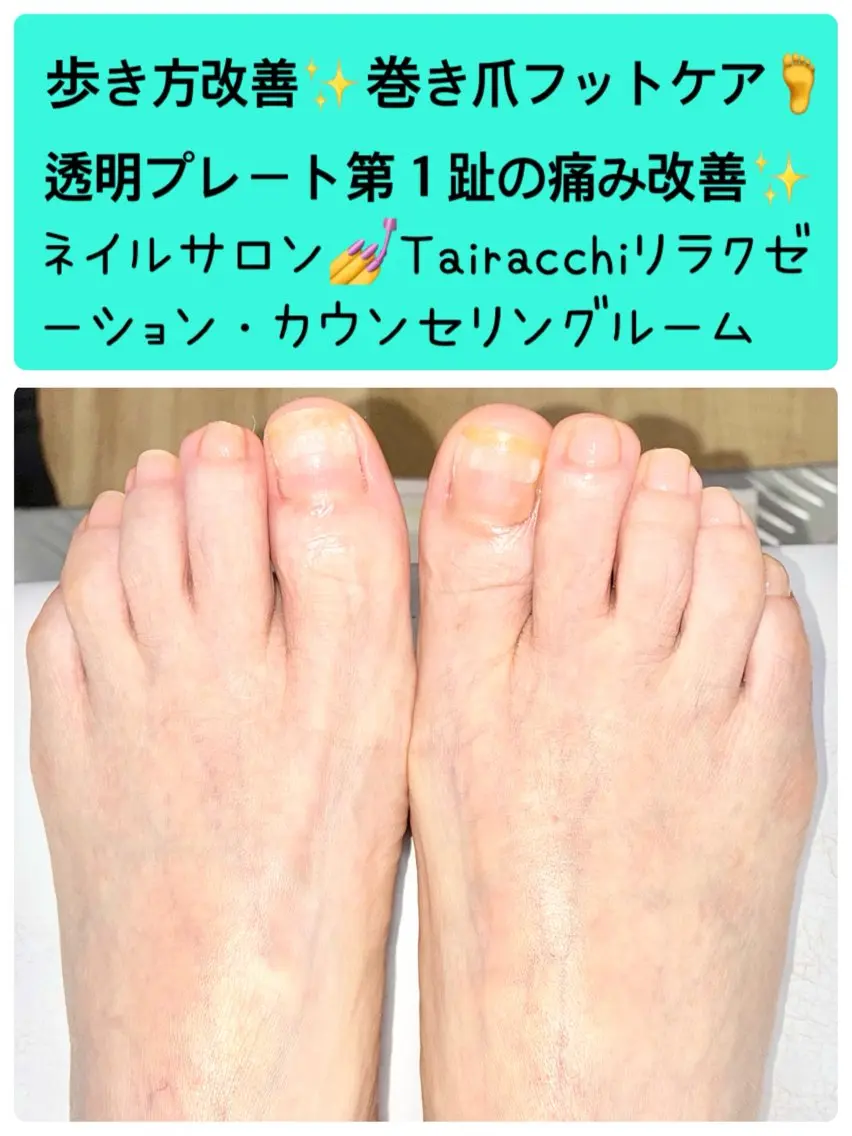 ネイル フットネイル Tairacchi タイラッチのエステ・リラクイメージ